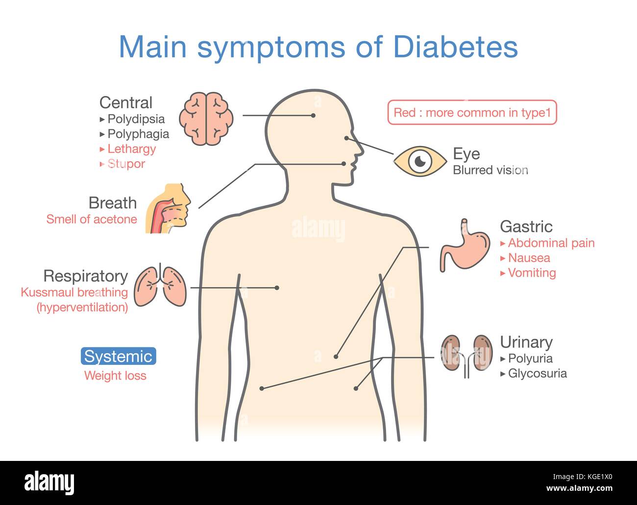 Illustration of main symptoms of Diabetes. Stock Vector