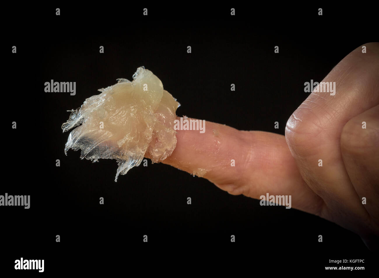 Petroleum jelly, vaseline, on a lady's finger. Stock Photo