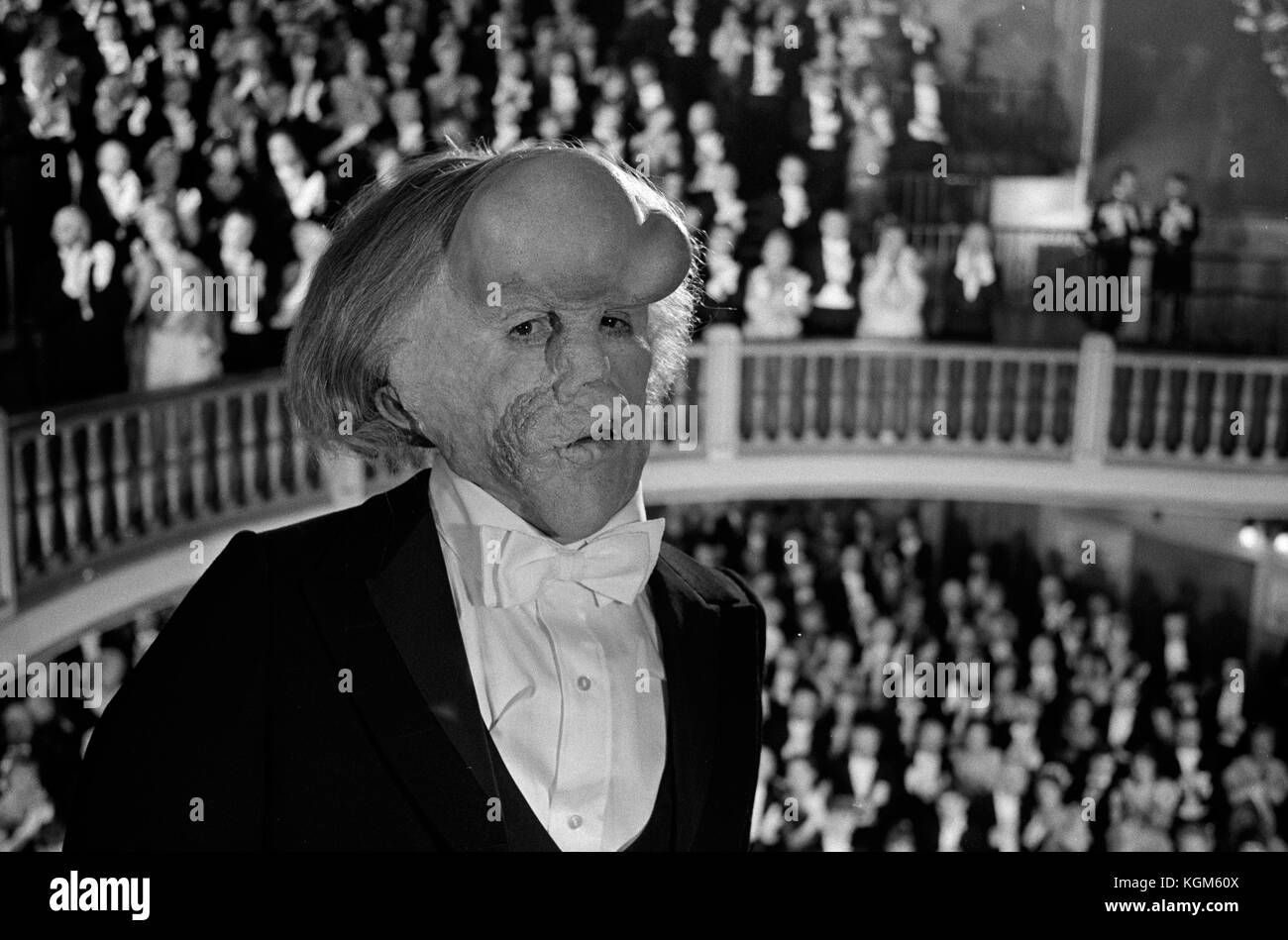 Elephant Man Disease