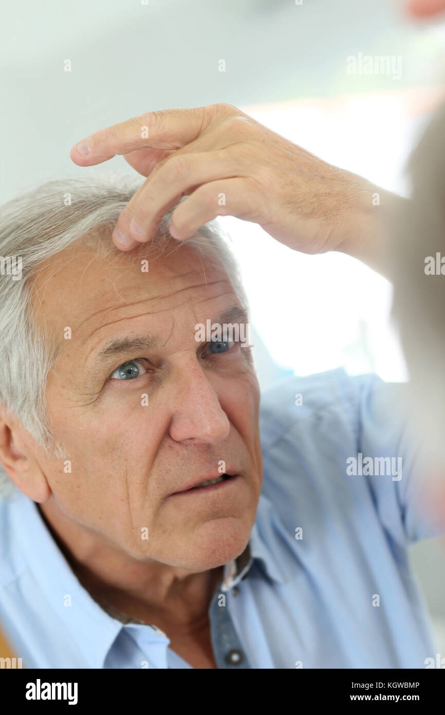 Senior man concerned by hair loss Stock Photo