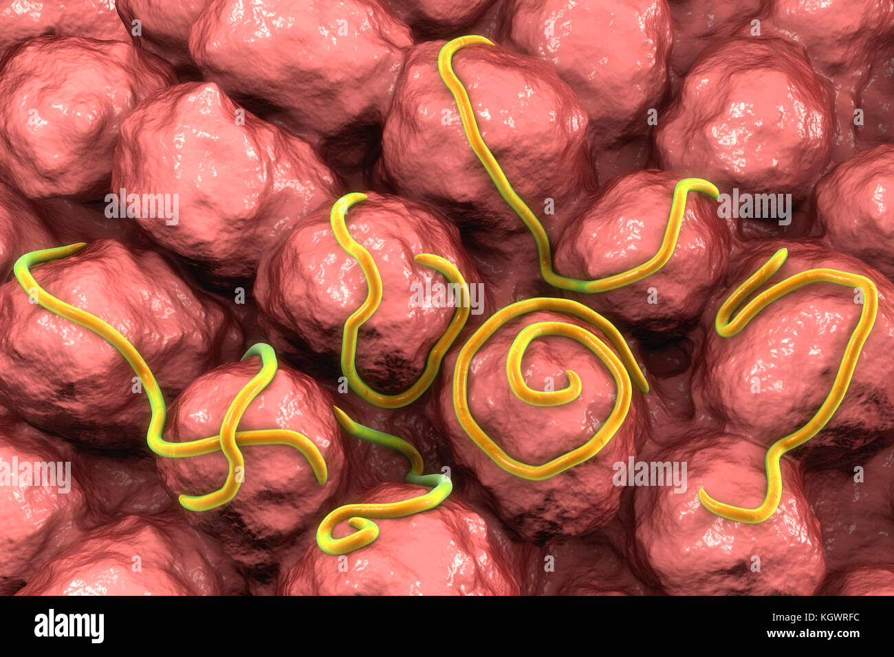 Threadworms in the gut. Computer illustration showing multiple threadworms (Enterobius sp.) on the interior of a human intestine. Threadworms are nematode worms that parasitize the large intestine and caecum of many animals. In humans they cause the common infection enterobiasis. Nematodes are unsegmented worms that may be parasitic or free-living depending upon the species. Stock Photo