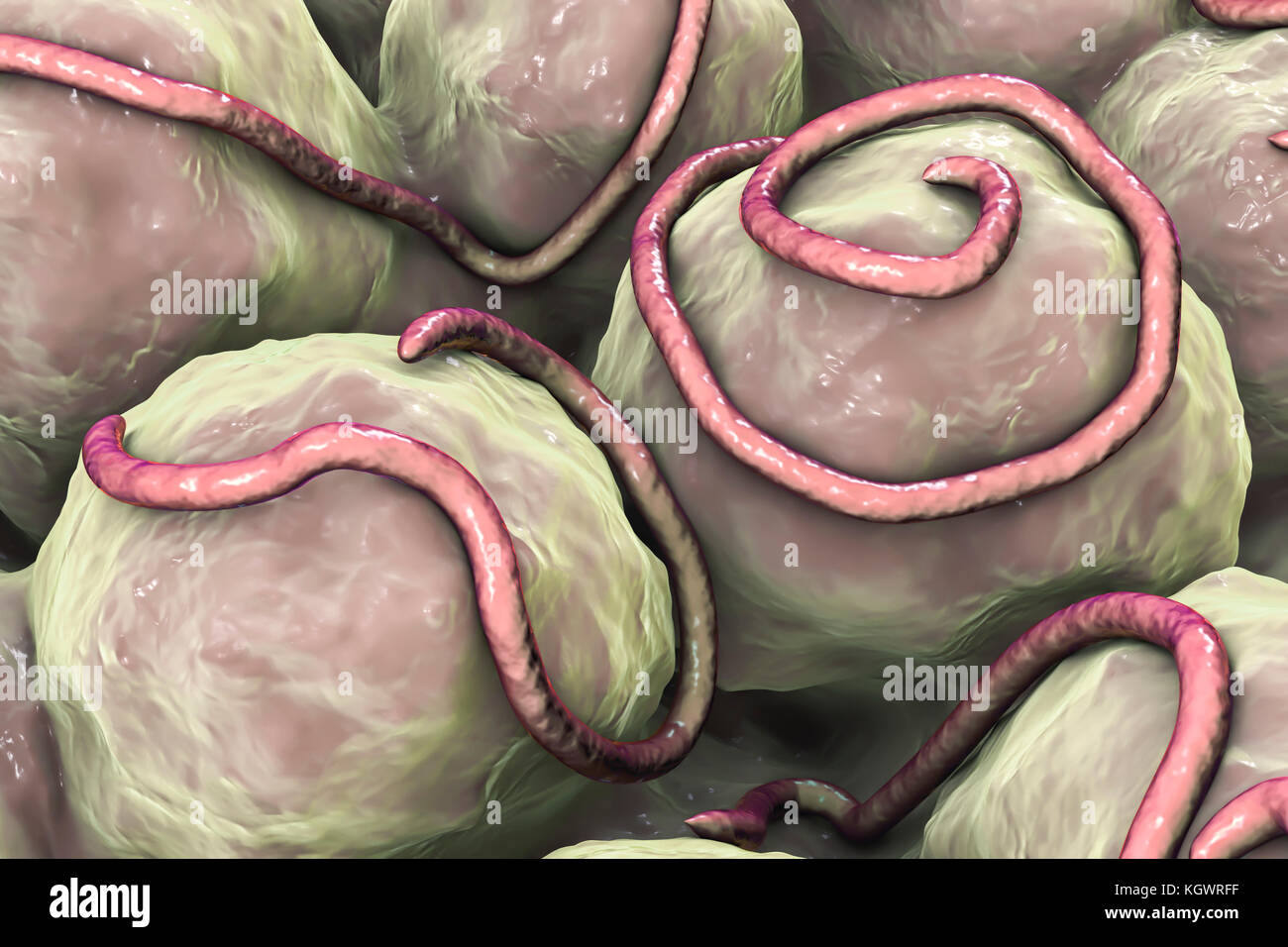 Threadworms in the gut. Computer illustration showing multiple threadworms (Enterobius sp.) on the interior of a human intestine. Threadworms are nematode worms that parasitize the large intestine and caecum of many animals. In humans they cause the common infection enterobiasis. Nematodes are unsegmented worms that may be parasitic or free-living depending upon the species. Stock Photo