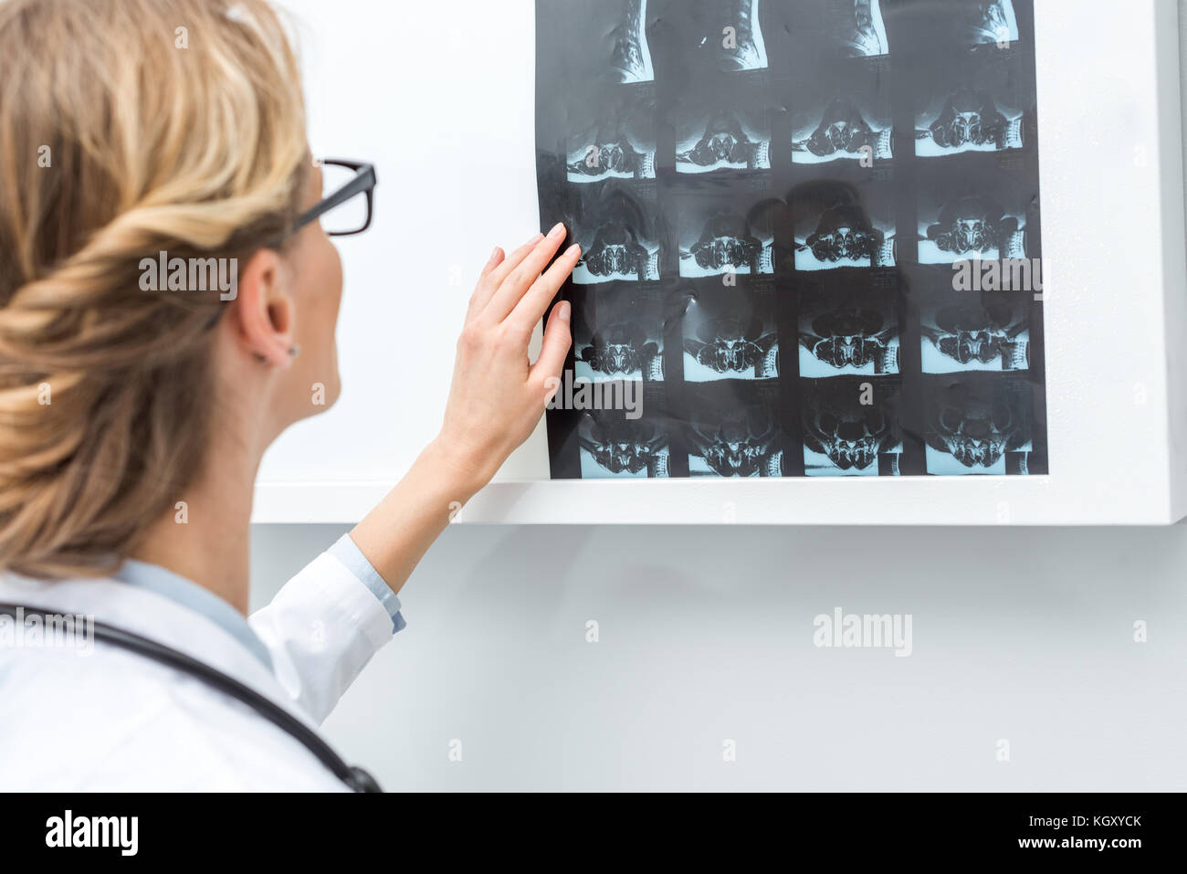 Black female doctor x ray hi-res stock photography and images - Alamy