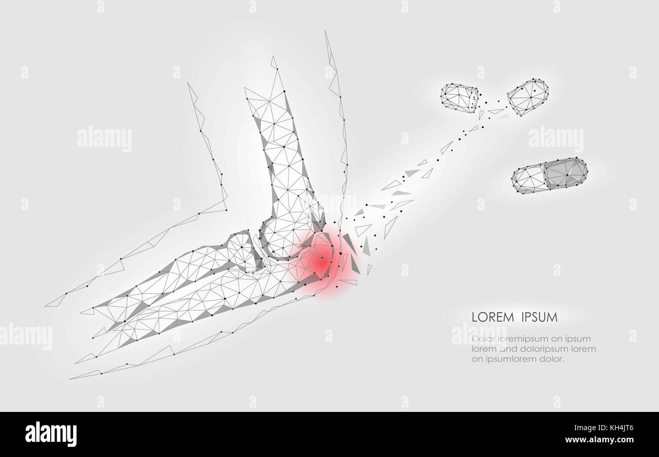 Drug capsule cure elbow joint disease. Red pain area low poly geomentic future medicine concept