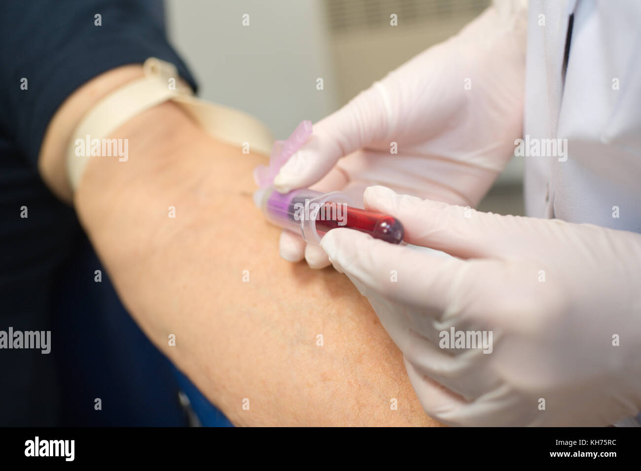 Why blood is taken from the ring finger from the point of view of the anatomy Preparation for blood tests from the finger 86 Why blood is taken from the ring finger from the point of view of the anatomy Preparation for blood tests from the finger 48