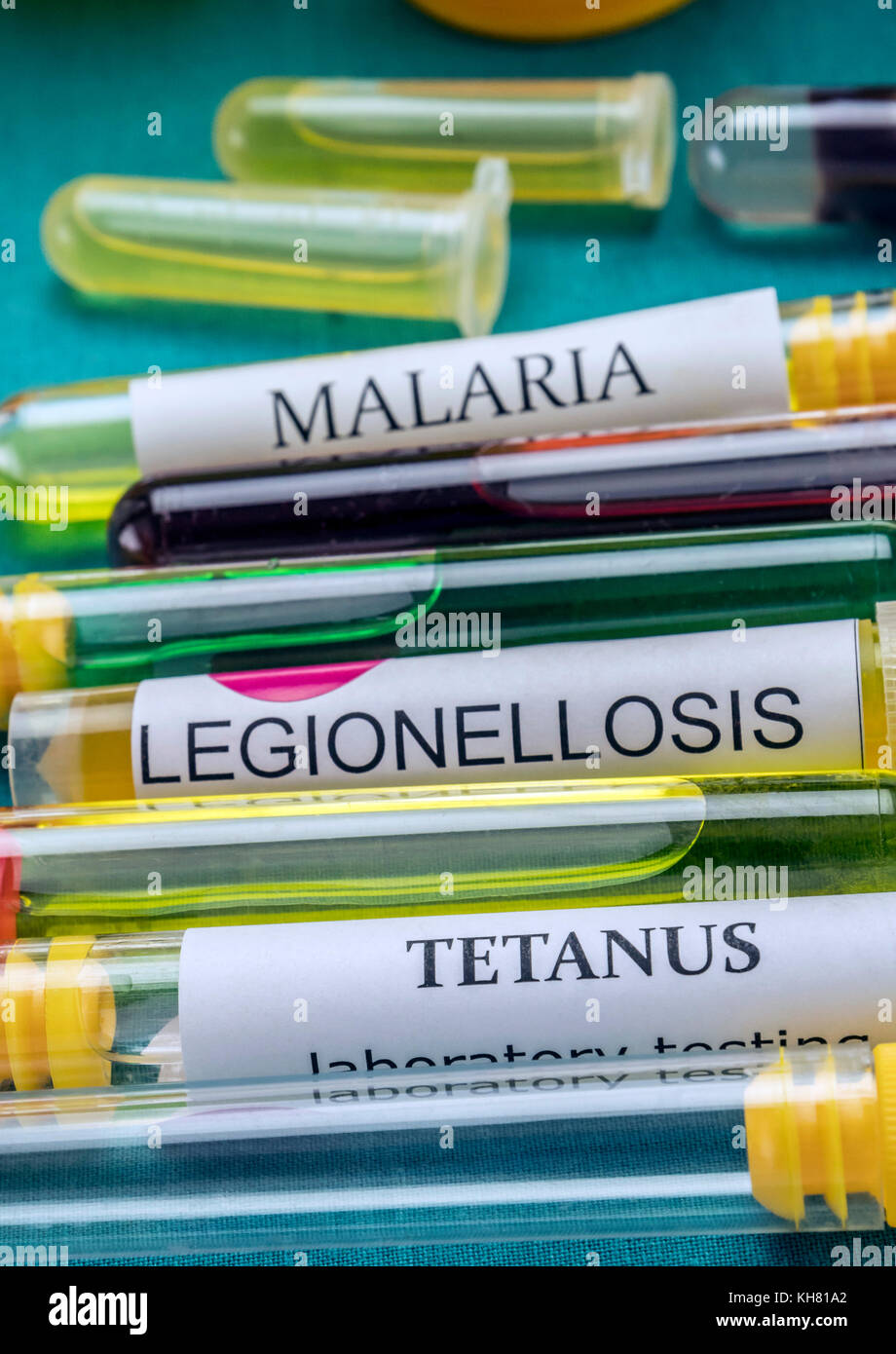 Some vials with samples of contagious diseases in a clinical laboratory