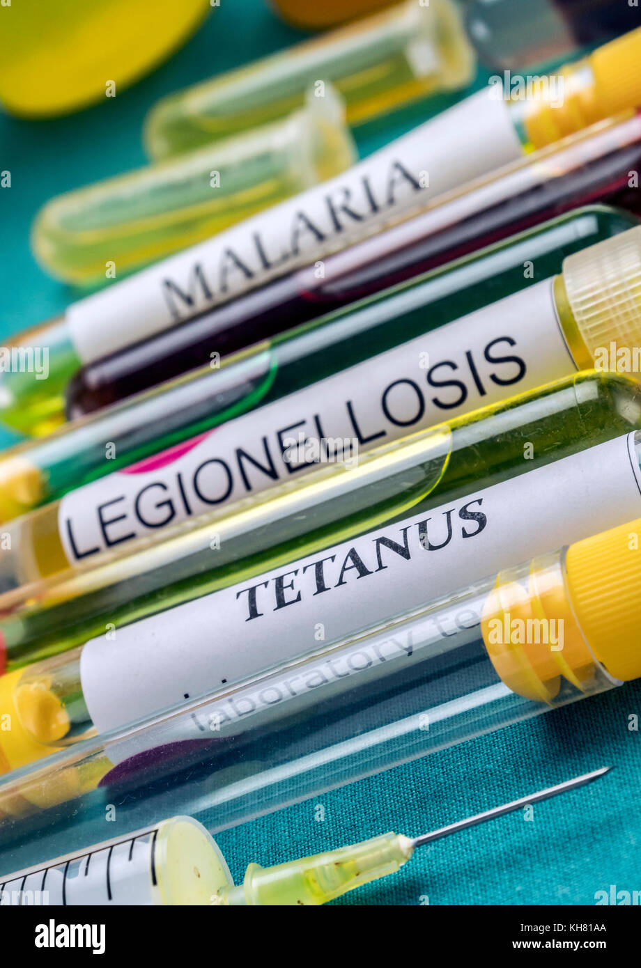 Some vials with samples of contagious diseases in a clinical laboratory Stock Photo
