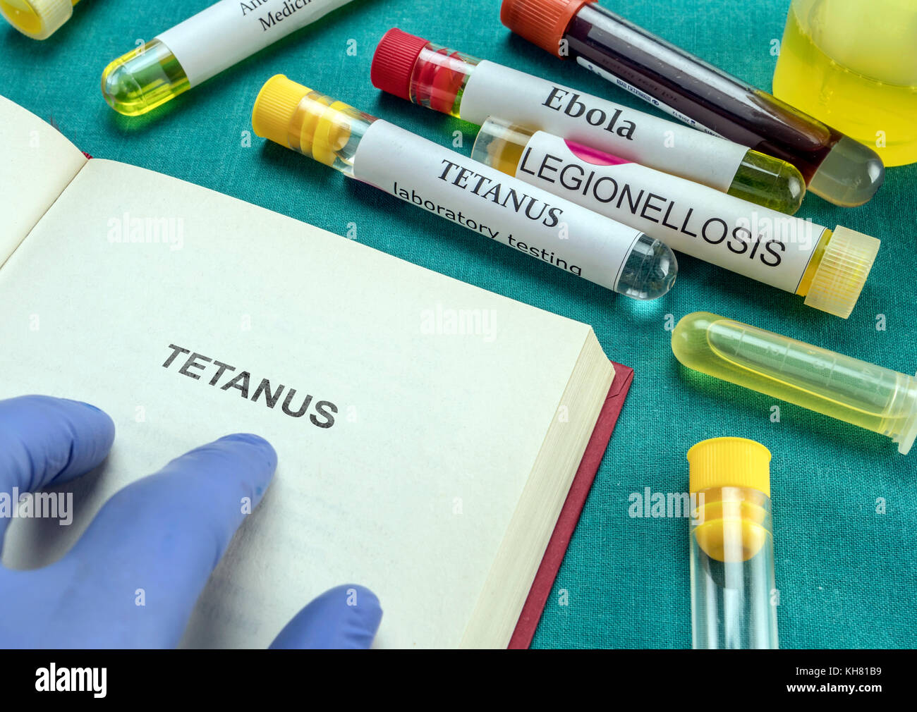 Doctor take Open Book Of Tetanus, Conceptual Image Stock Photo