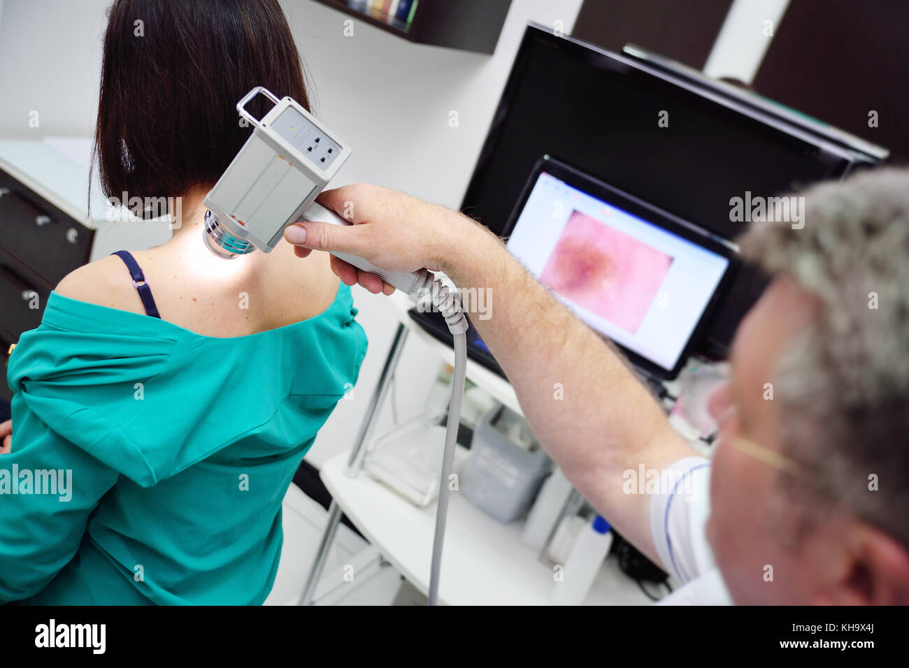 The doctor examines neoplasms or moles on the patient's skin Stock Photo