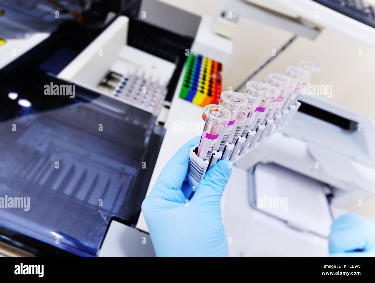Blood chemistry analyzer hi-res stock photography and images - Alamy