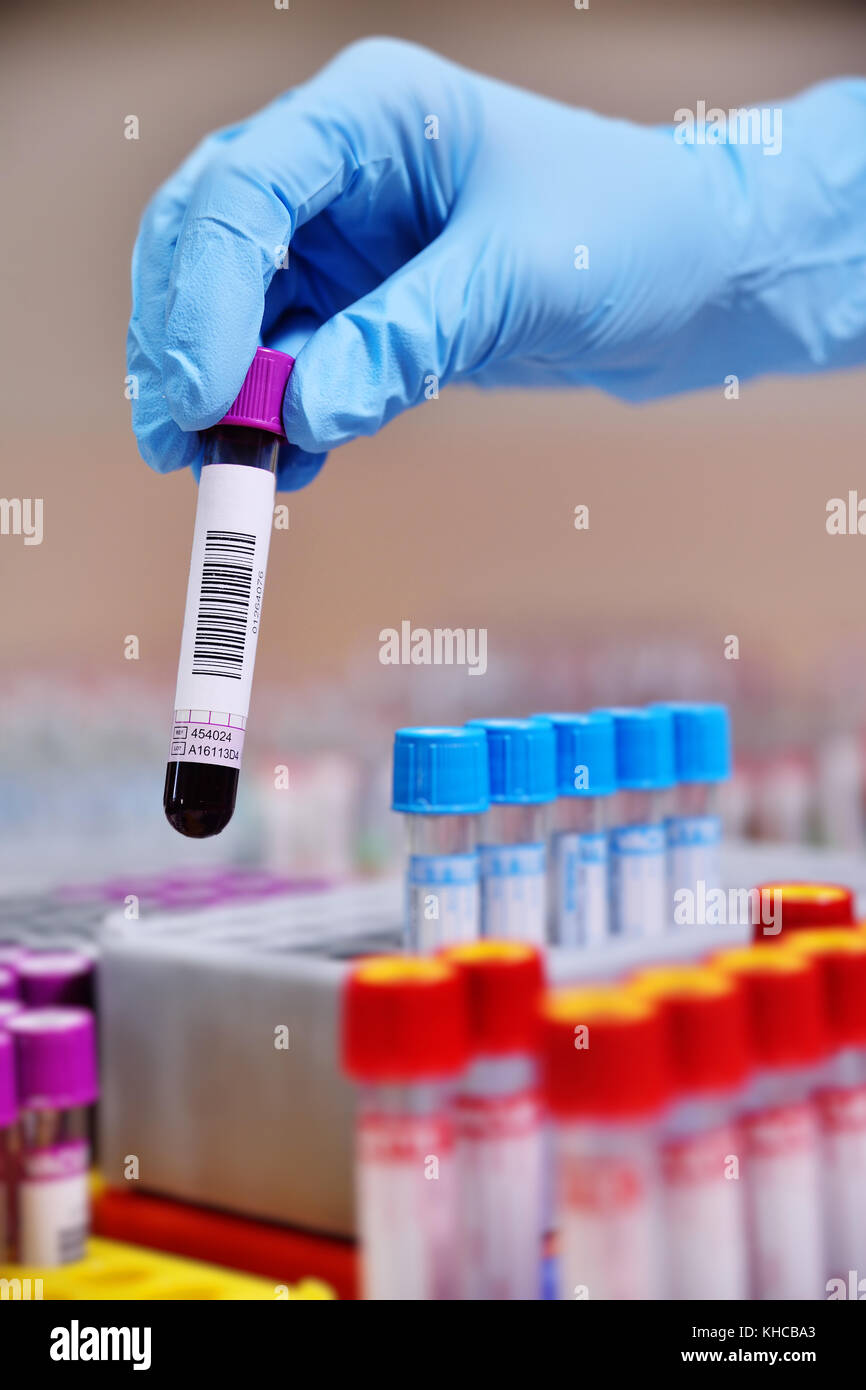 medical test tubes with blood tests Stock Photo Alamy
