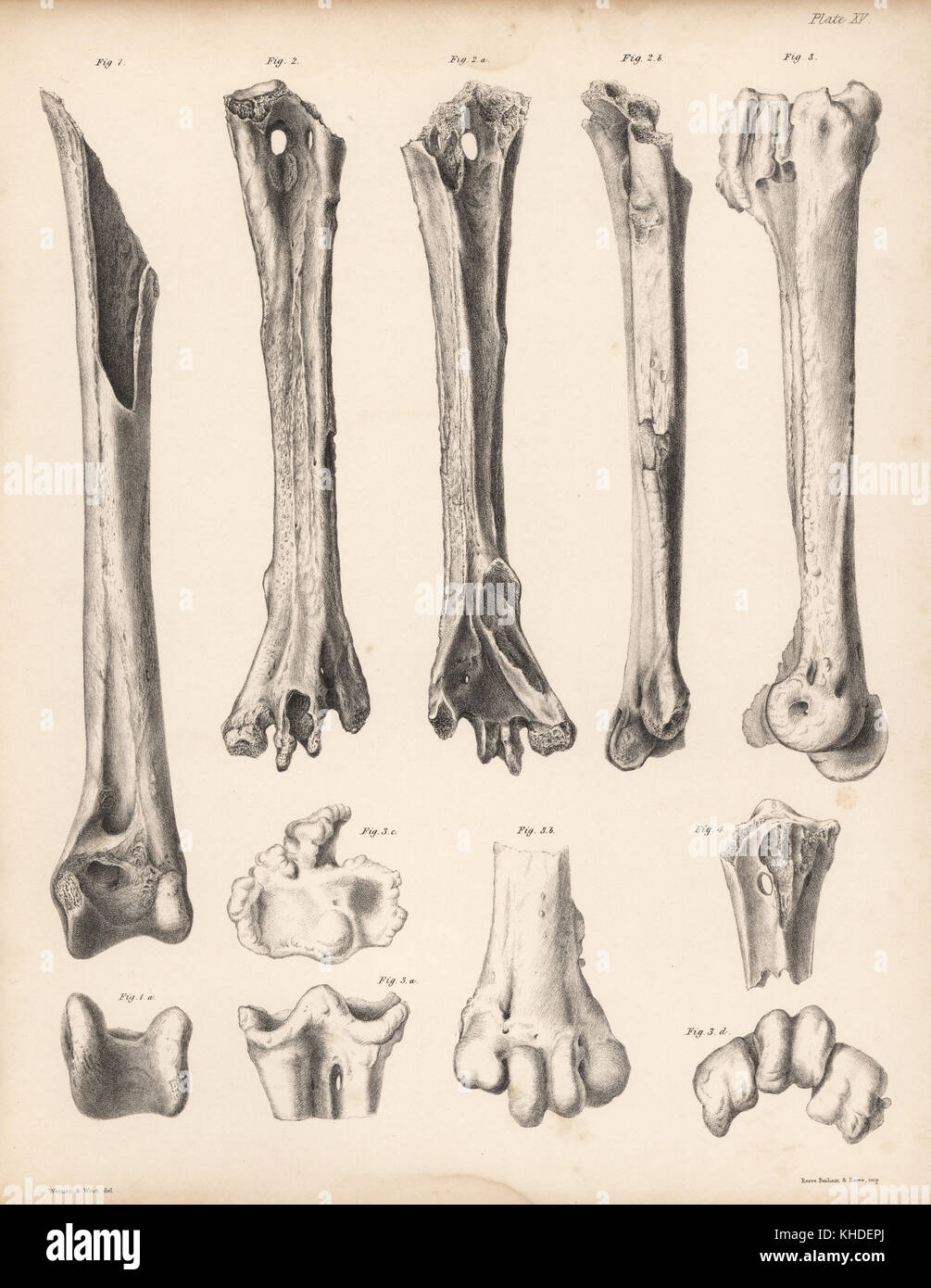 Tibia and metatarsus of the extinct Rodrigues solitaire, Pezophaps solitaria, in the Parisian Collection and Andersonian Collection. Lithograph after Werner and Tuffen West from Hugh Edwin Strickland and Alexander Gordon Melville's The Dodo and its Kindred, London, Reeve, Benham and Reeve, 1848. Stock Photo