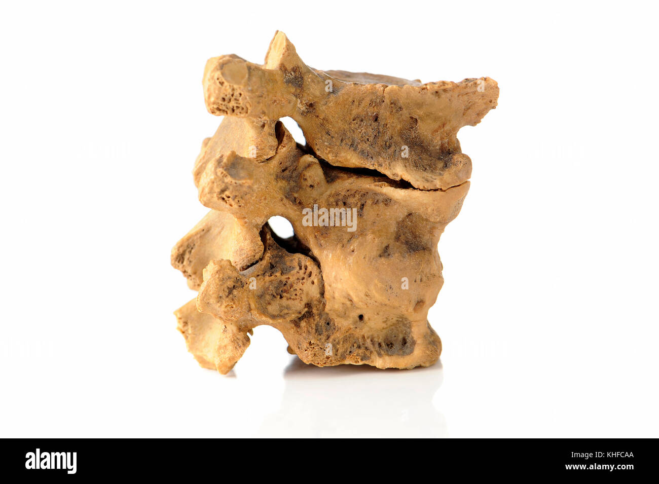 Part of human spine, backbone, isolated on white. Medical example Stock Photo Alamy