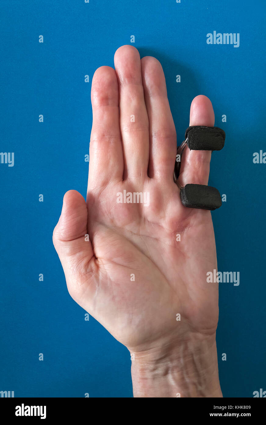 Finger splint on a little 'pinkie' finger after Dupuytren's Contracture corrective surgery to straighten finger and remove scar tissue. Stock Photo