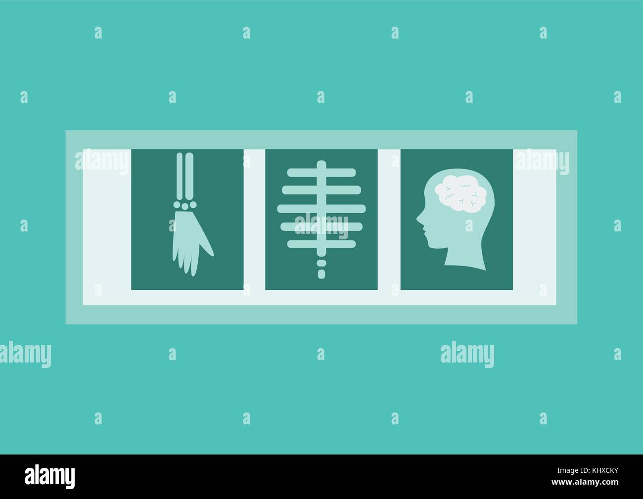 X-ray films in flat style. Vector Illustration Stock Vector Image & Art ...