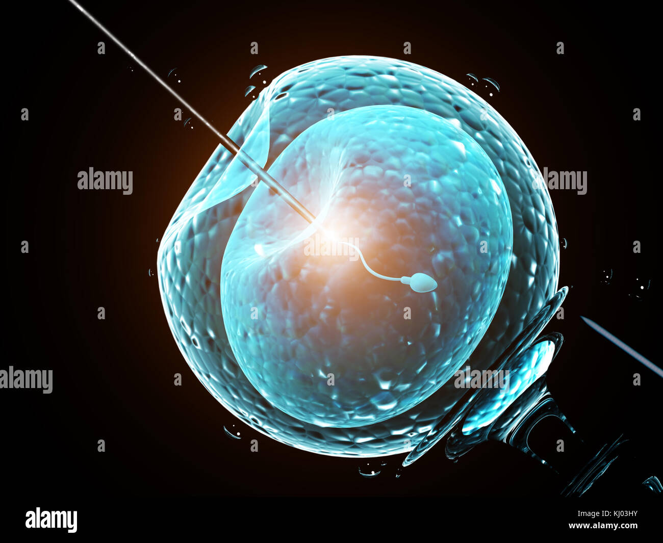 Human Artificial Insemination