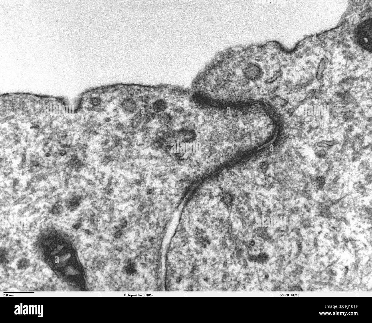 Junctional complex and pinocytotic vesicles - embryonic brain-TEM Stock ...