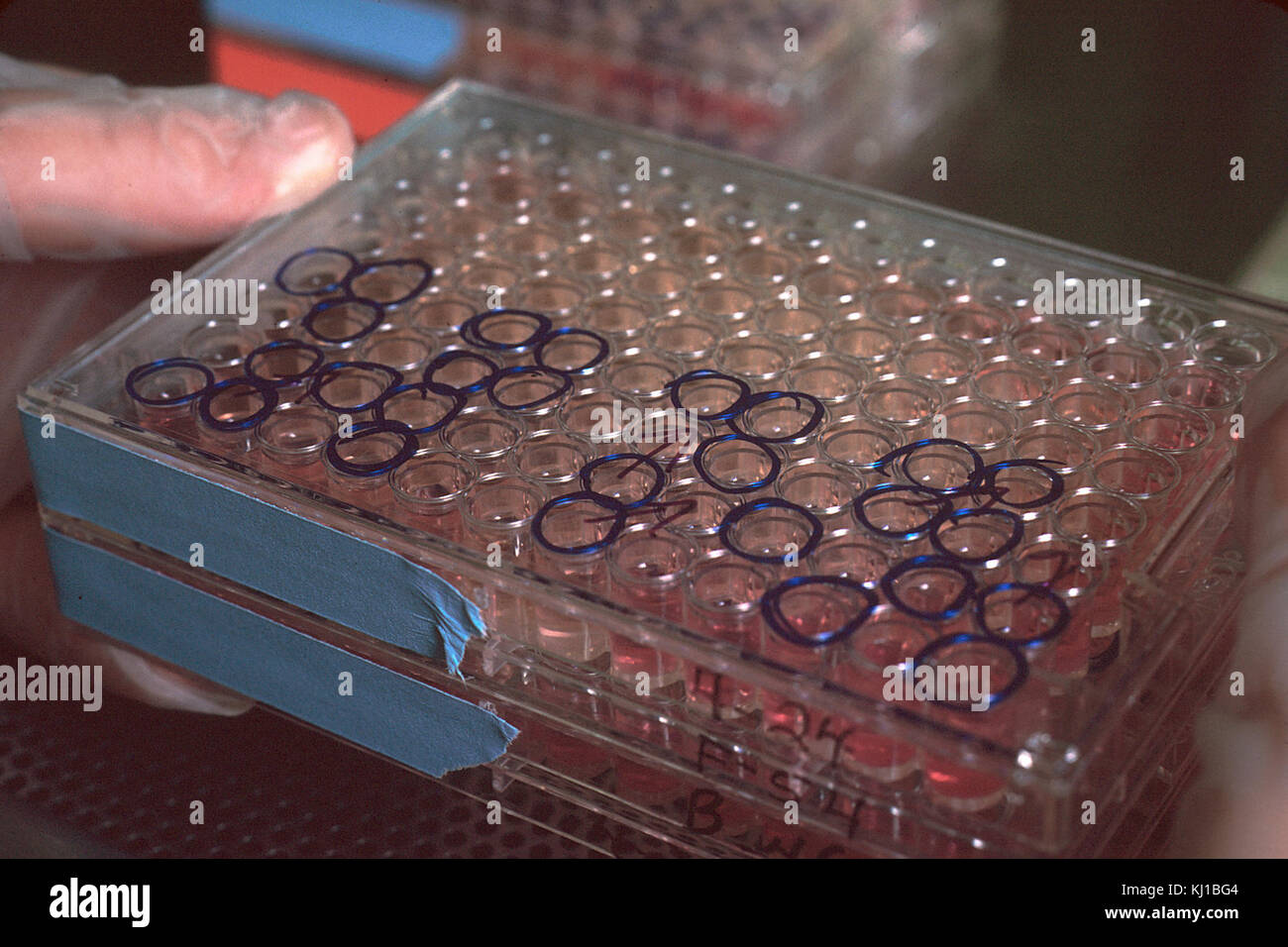 Monoclonal antibody hi-res stock photography and images - Alamy