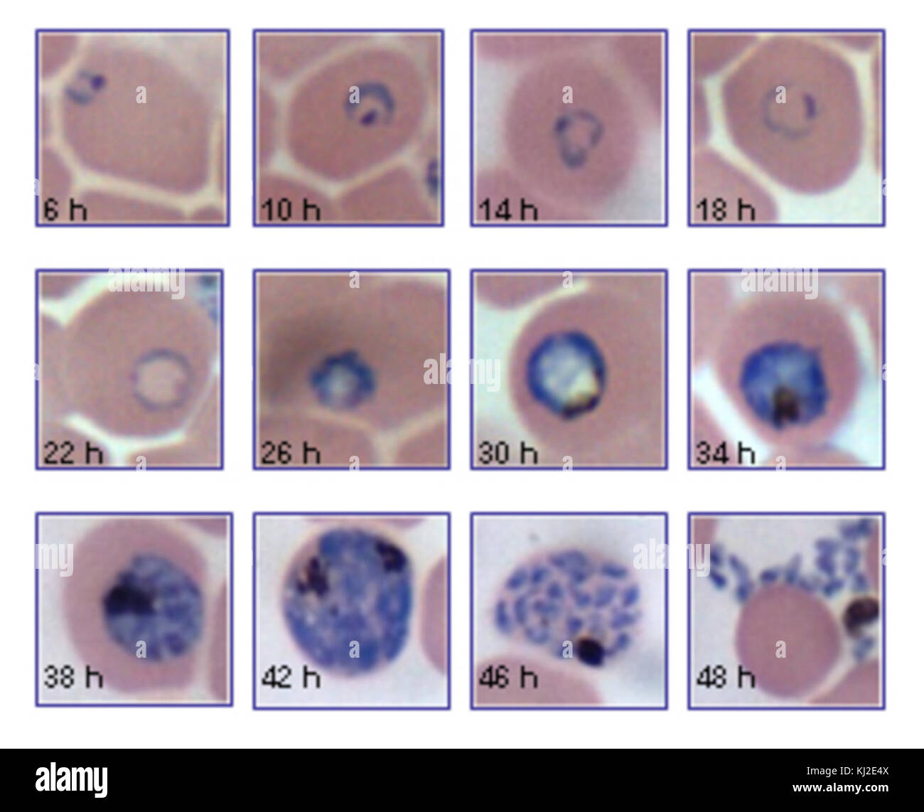 Blood Stages Of P Falciparum Over 48h Stock Photo Alamy Blood Stages Of P Falciparum Over 48h Stock Photo Alamy