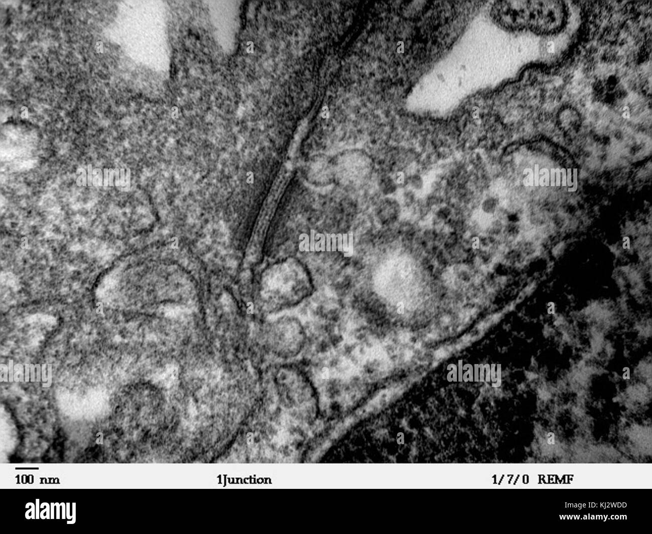 Desmosome - epithelial cell from mammalian lung tissue - TEM Stock Photo