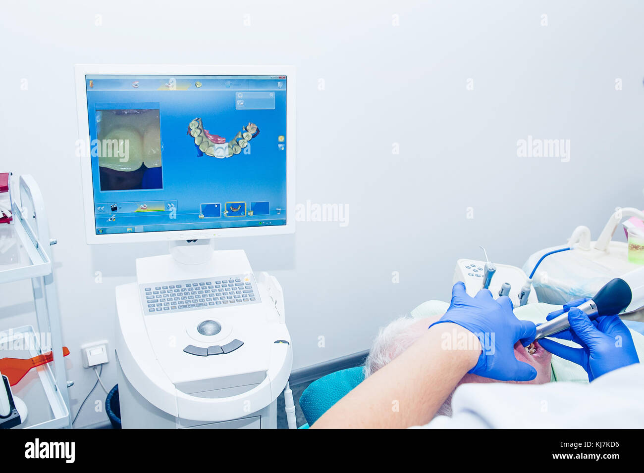 Doctor modeling prosthesis using CAD CAM dental computer-aided machine in a highly modern dental laboratory. Dentistry, prostodontics, prosthetics and Stock Photo