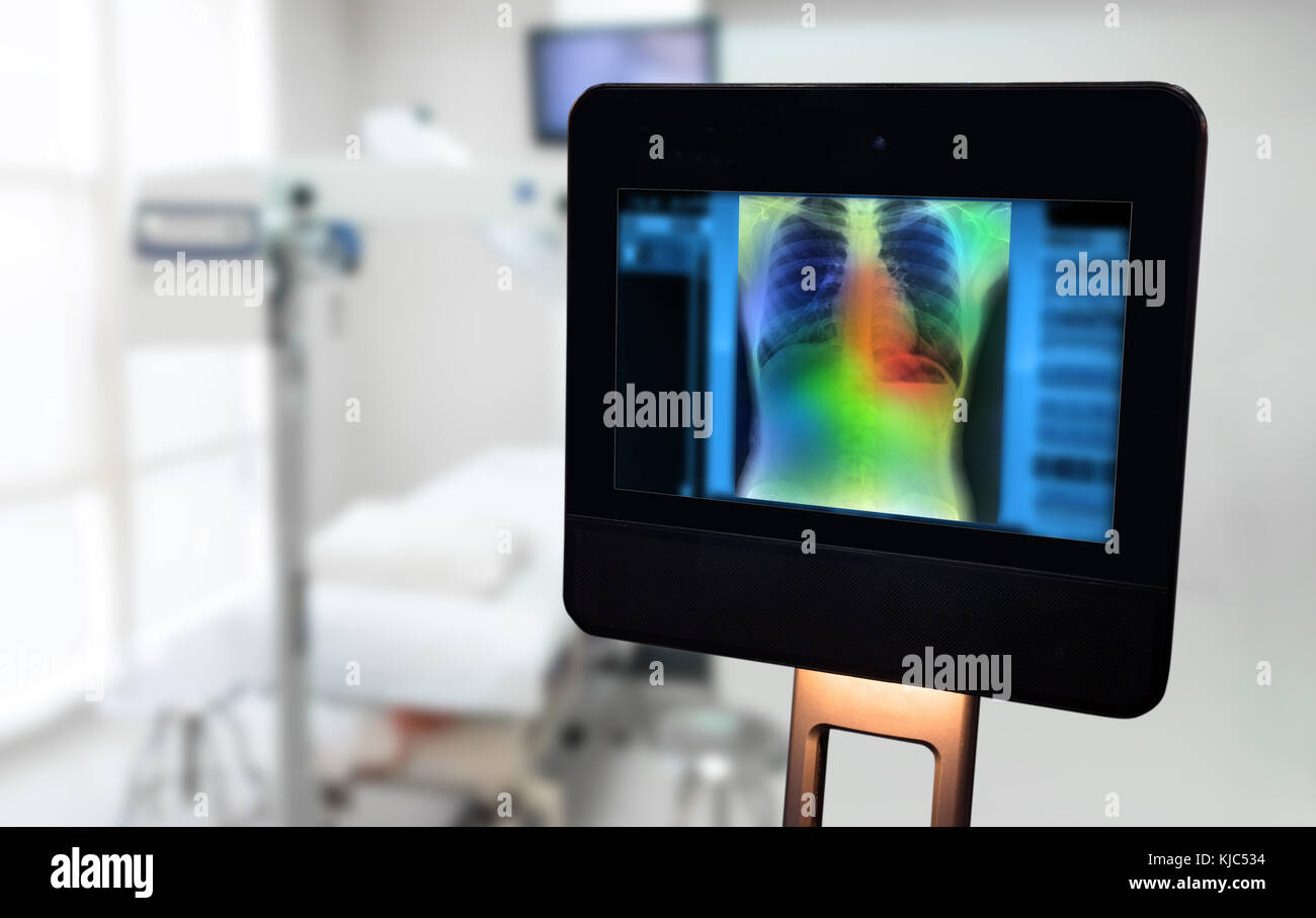 Artificial intelligence in smart healthcare hospital technology concept. Robot assistant , adviser use AI algorithm and machine learning detect Pneumo Stock Photo
