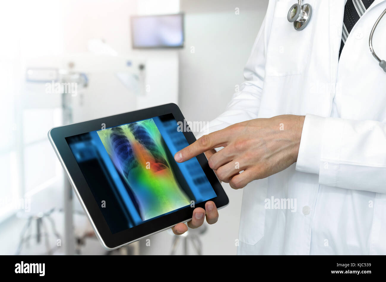 Artificial intelligence in smart healthcare hospital technology concept. Professional doctor use AI algorithm and machine learning detect Pneumonia an Stock Photo