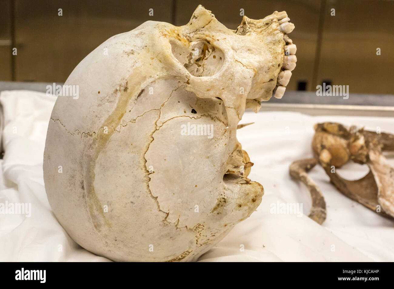 Tucson, Arizona - The skull of an unidentified migrant who died 
