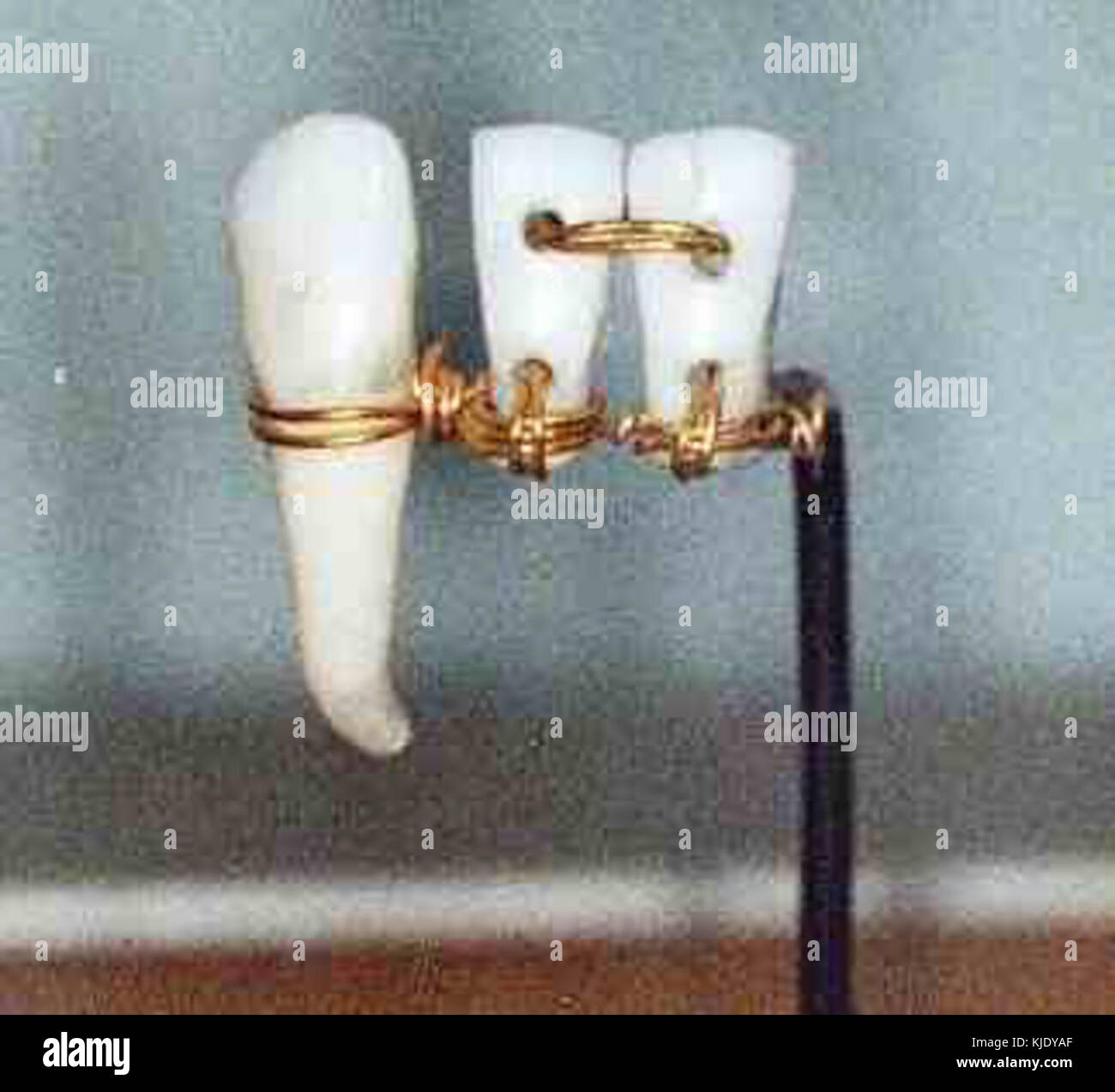 Ancient Egypt Dentistry4 Stock Photo - Alamy