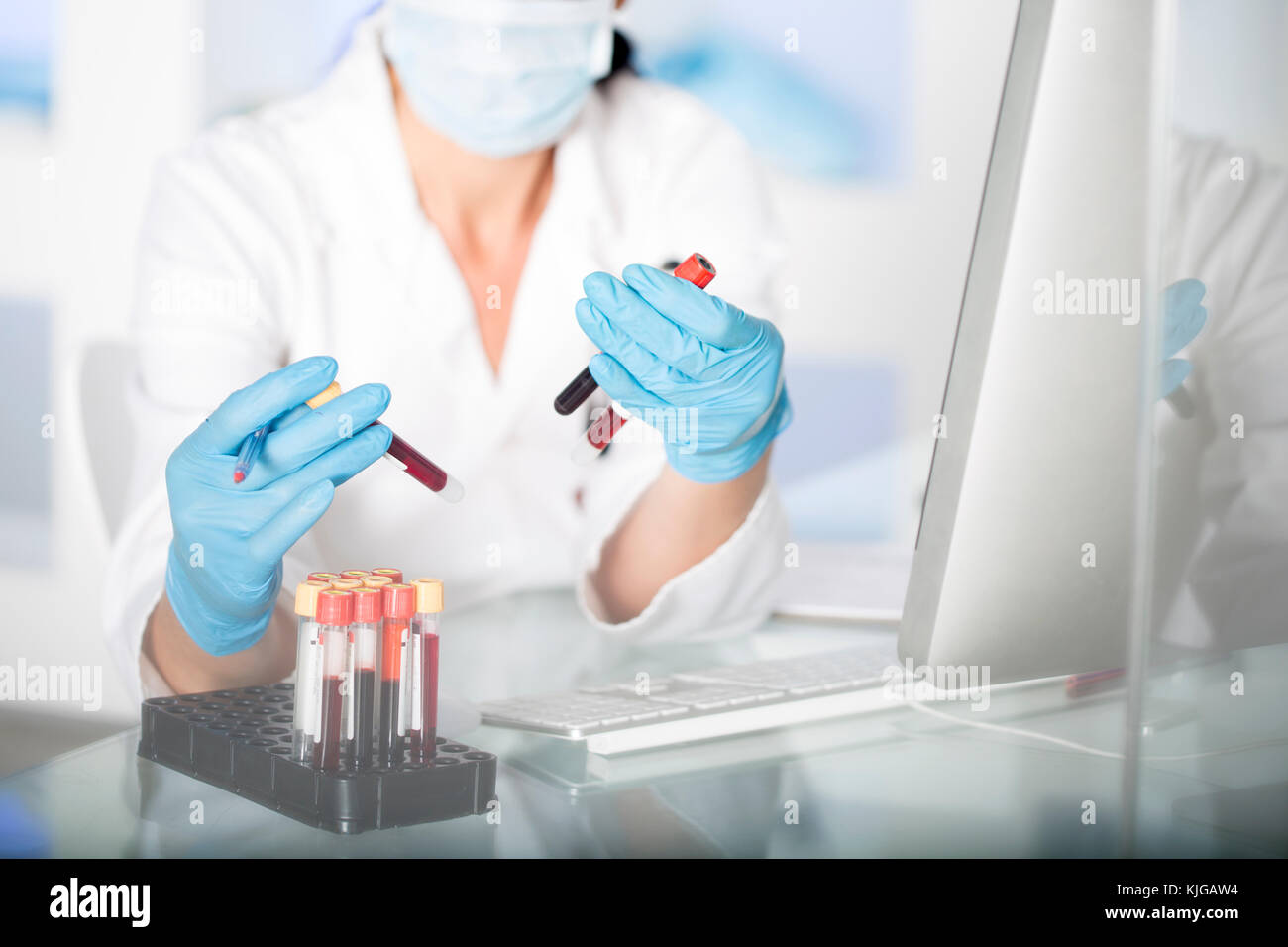 Микроальбуминурия в какую лабораторию сдают. Лаборатории для сдачи анализов рядом со мной. Микроальбуминурия в какую лабораторию сдают. Забор анализов на дому. Лаборатории для сдачи анализов рядом со мной.