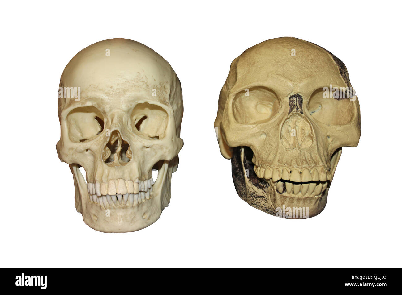 Comparison Piltdown Man vs Modern Human Skull Front View Stock Photo