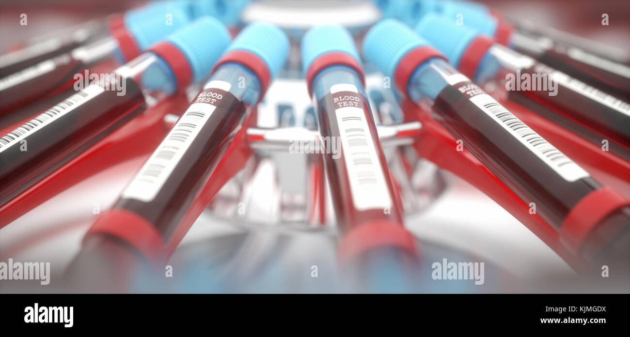 Lab equipment centrifuging blood. Concept image of a blood test. Stock Photo
