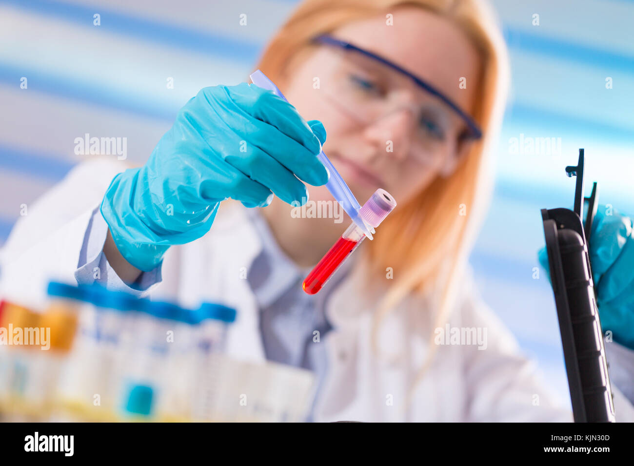 Female laboratory assistant with blood test for AIDS Stock Photo Alamy