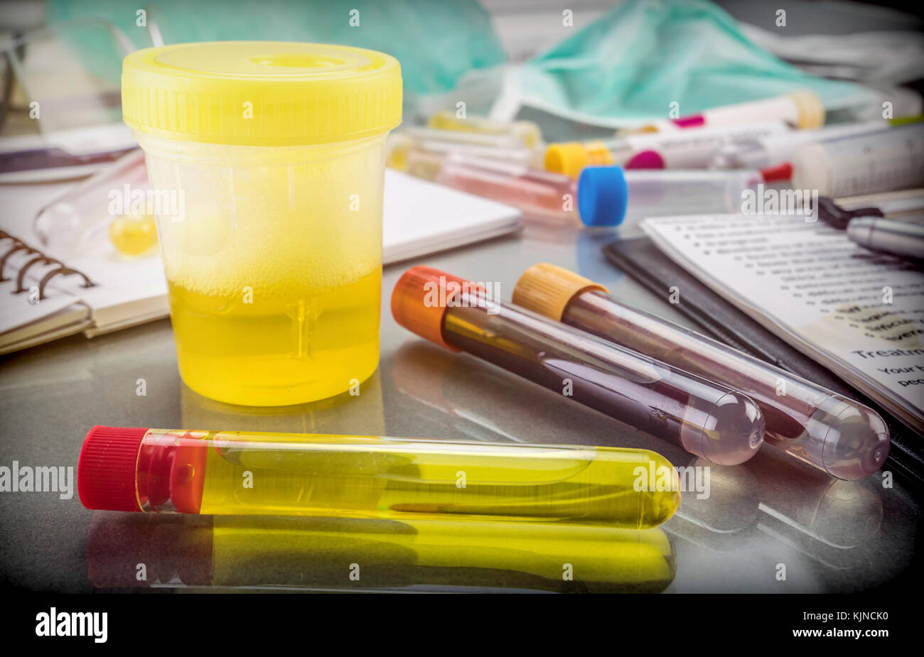 Some vials with samples of contagious diseases in a clinical laboratory