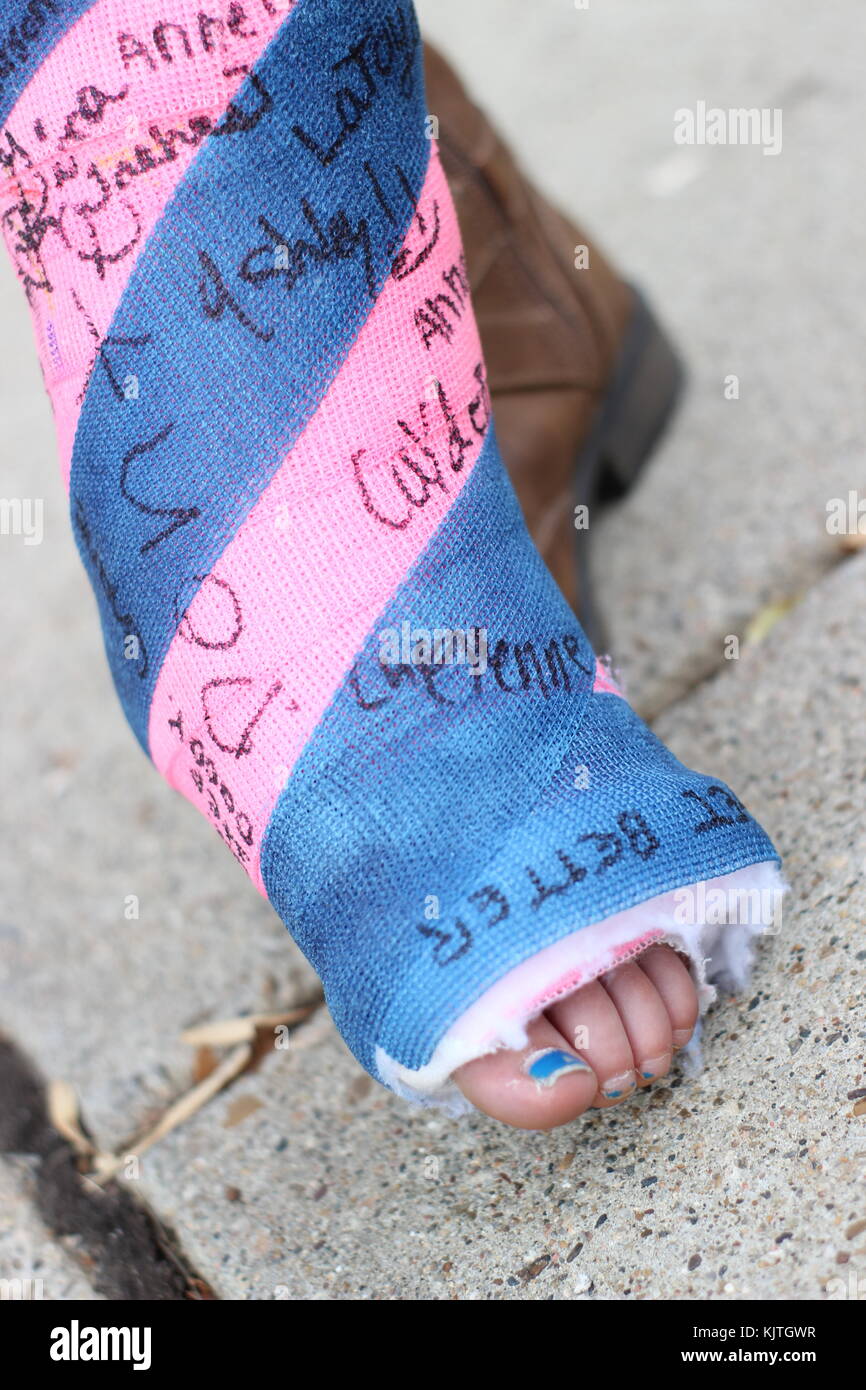 close up of a small childs cast on foot and ankle with signatures on it, pink and blue Stock Photo