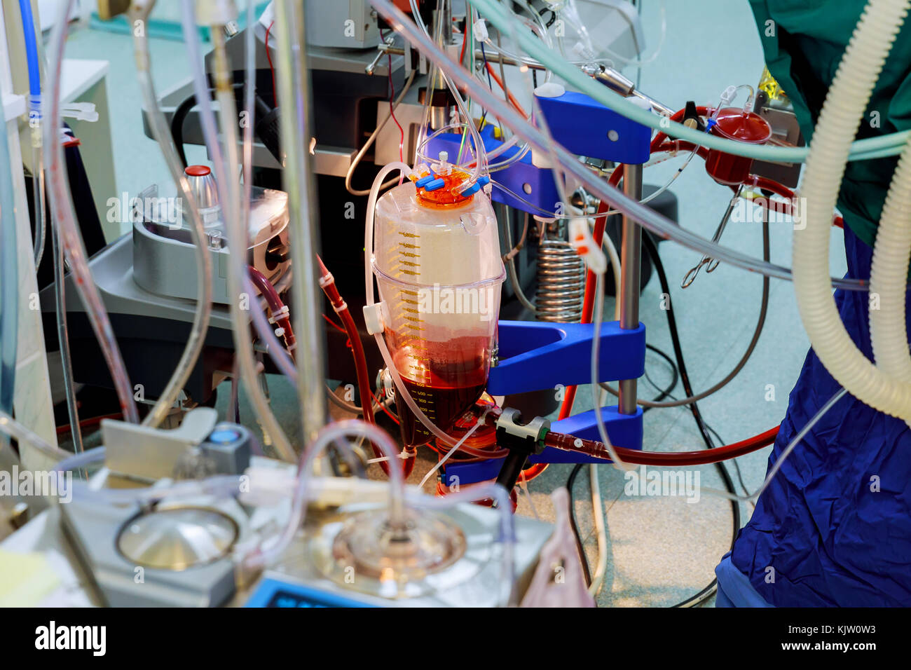 Transfusion and infusion at surgery Blood transfusion to patient at recovery room in hospital
