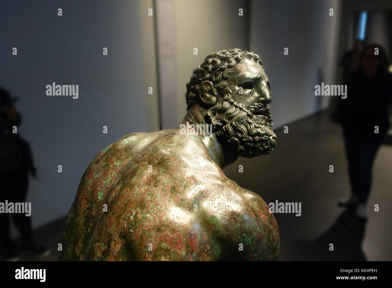 scarred and bruised face, cauliflower ears, broken nose Stock Photo Alamy