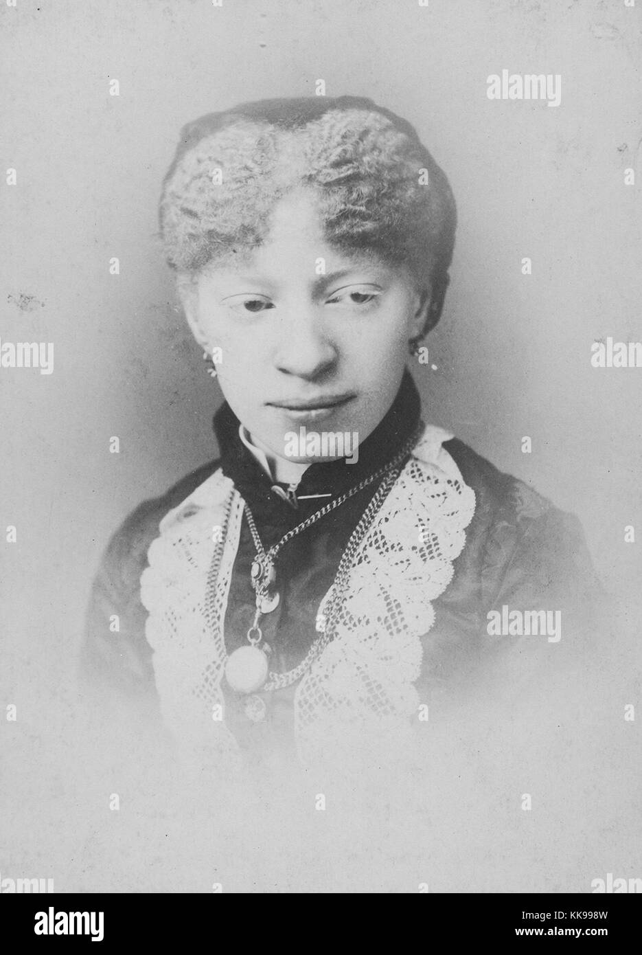 A photographic portrait of a woman identified as Miss Perry, she is an African-American women who has albinism, the condition causes an absence of pigment in her skin, hair and eyes, she is wearing a dark colored dress with white lace accents, she also wears several necklaces, 1900. From the New York Public Library. Stock Photo