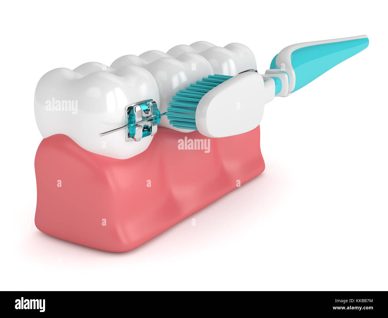 3d render of teeth with braces and toothbrush isolated over white ...