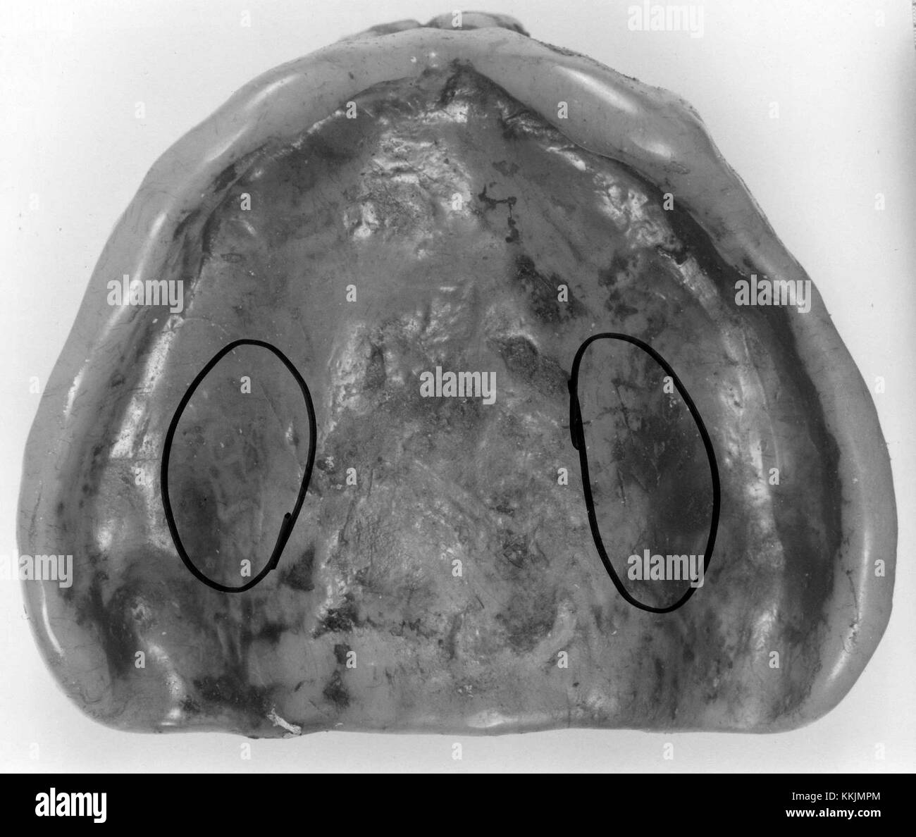 Vernon County Jane Doe maxillary denture Stock Photo Alamy