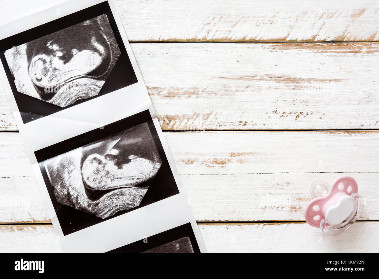 Ultrasound on white wooden background Stock Photo