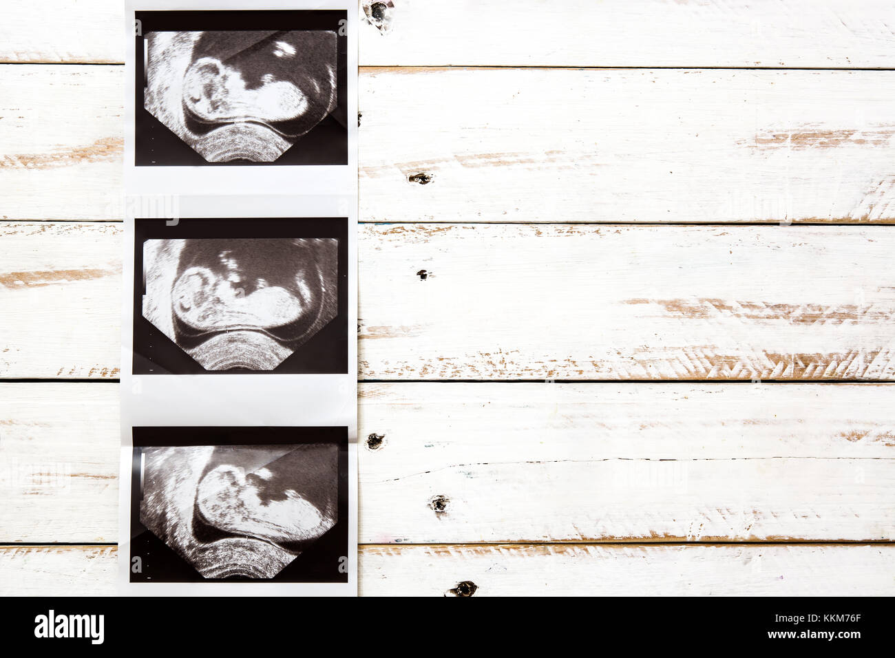 Ultrasound on white wooden background Stock Photo