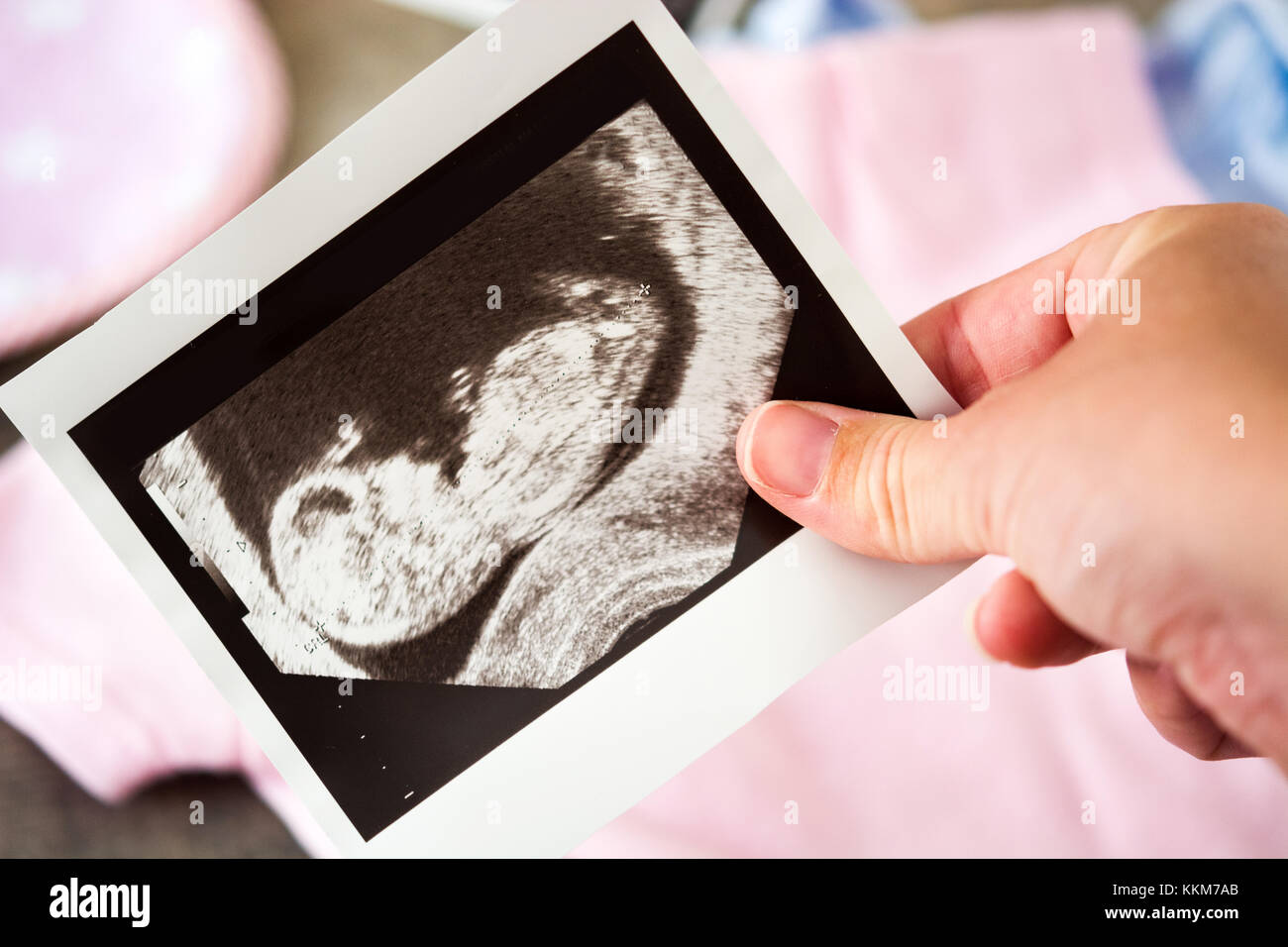 Pregnant woman holding ultrasound scan Stock Photo