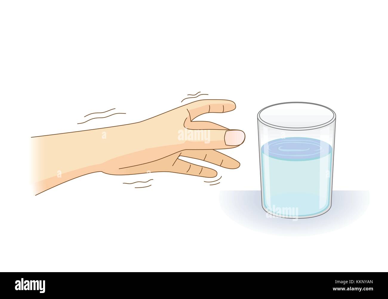A Hand have tremor symptom reaching out for a glass of water. Stock Vector