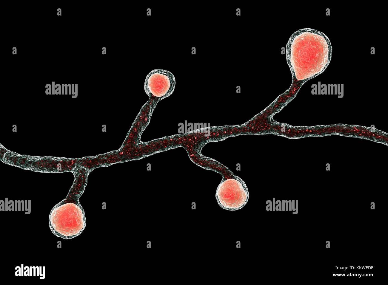 Blastomyces dermatitidis fungus, computer illustration. This fungus is