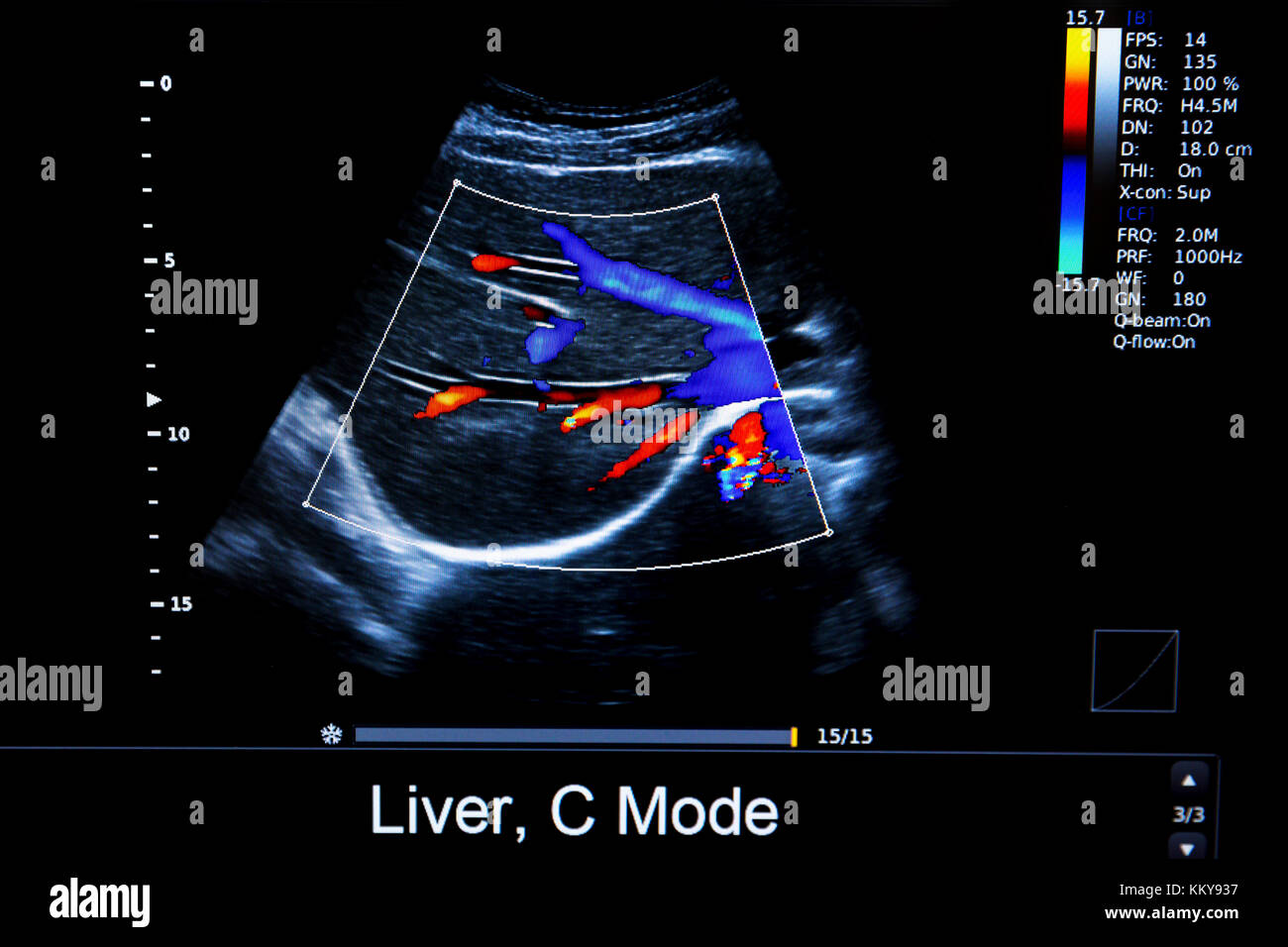 Colourful image of modern ultrasound monitor. Ultrasonography machine