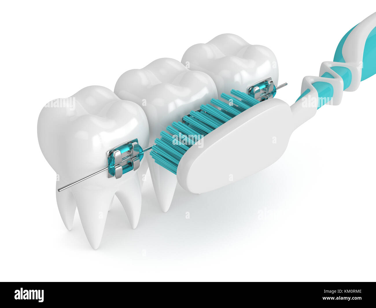 3d render of teeth with braces and toothbrush isolated over white ...