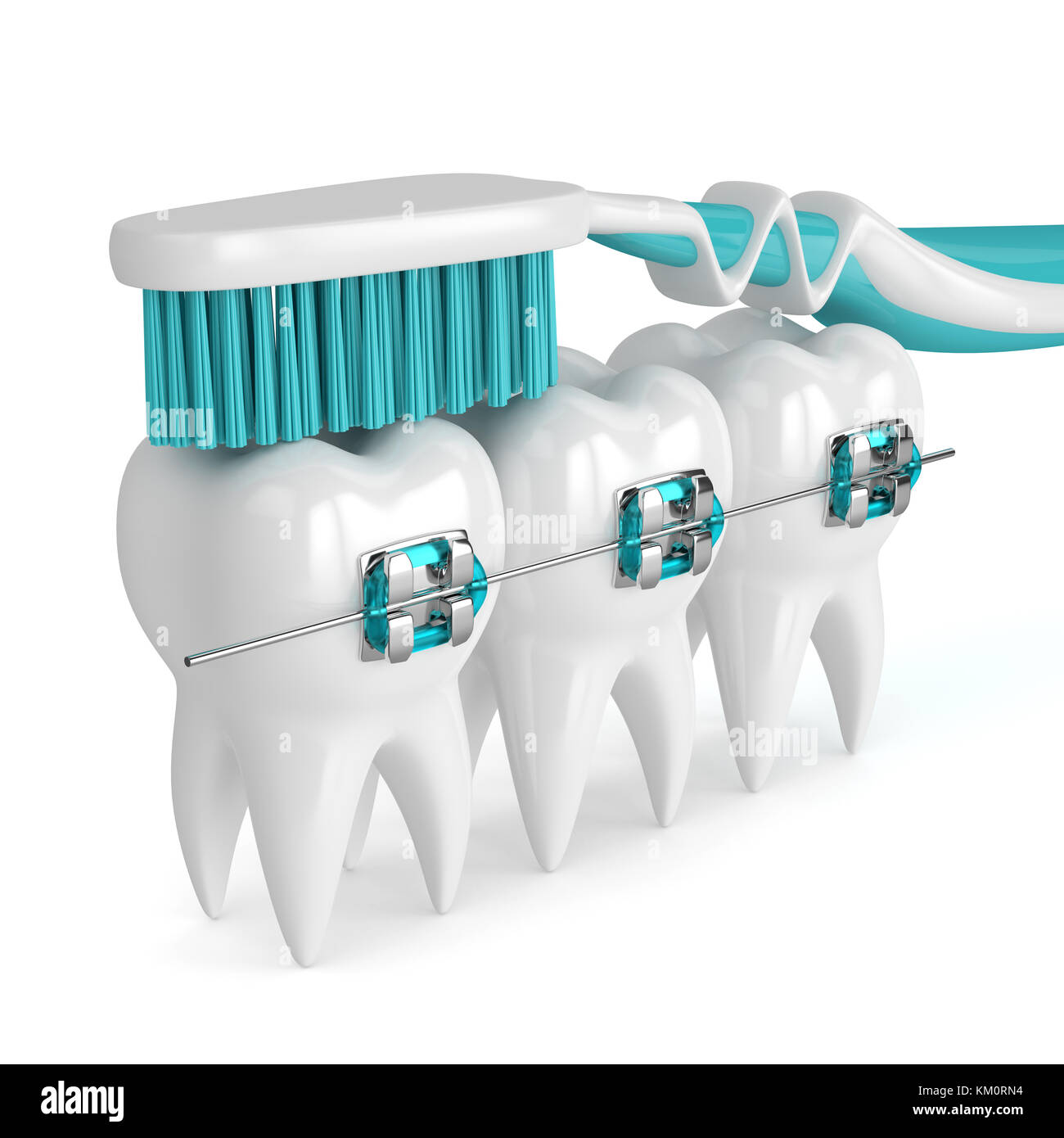 3d render of teeth with braces and toothbrush isolated over white ...