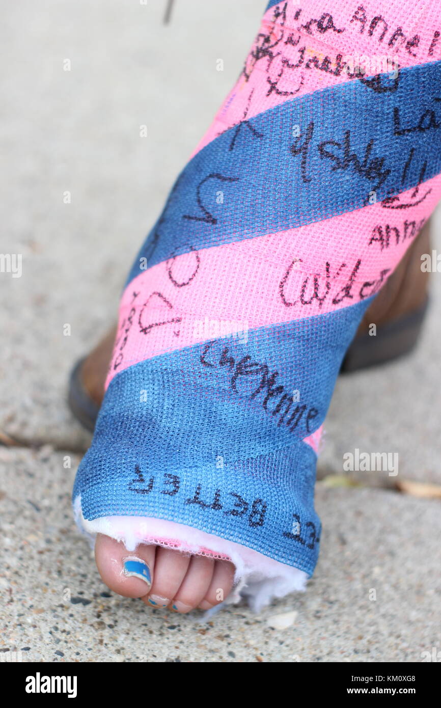 close up detail of signed cast on small girls leg or foot in pink and blue Stock Photo