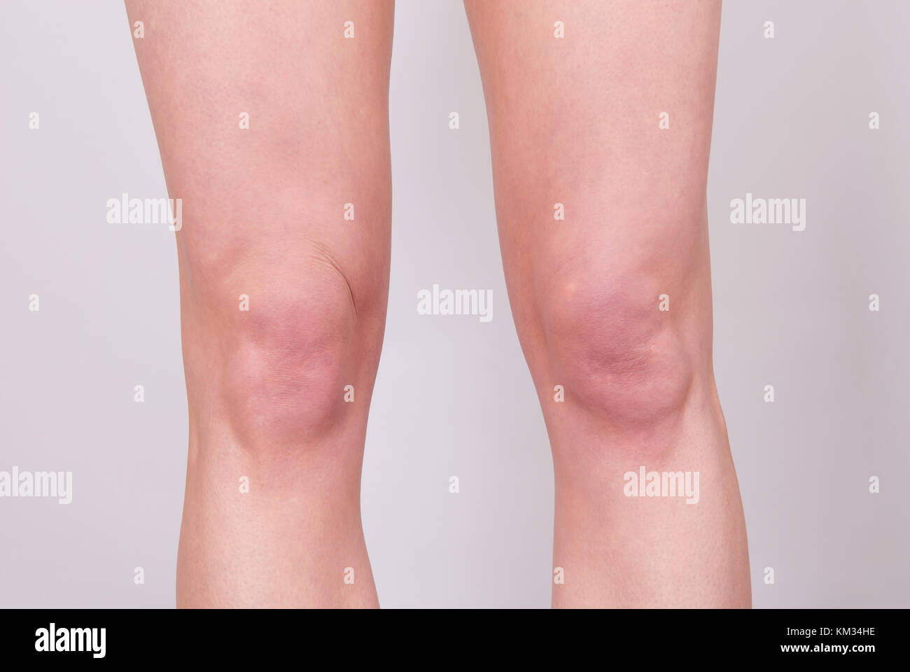 https://c8.alamy.com/comp/KM34HE/close-up-of-a-young-womans-knees-KM34HE.jpg